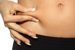 VelaShape body contouring treatment at Bair Medical Spa Albuquerque
